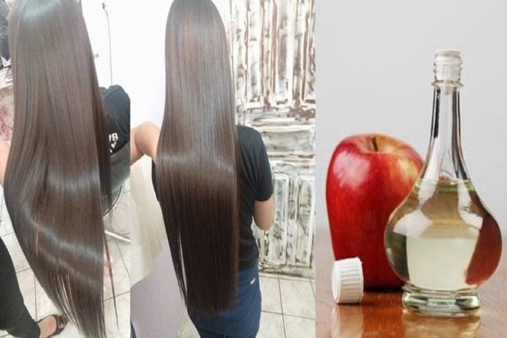 Vinagre de maçã nos cabelos para combater a queda e estimular o crescimento